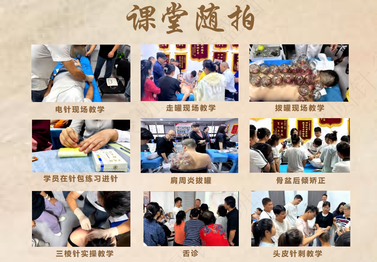 西安针灸学习